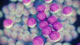 A magnified image of the MRSA bacteria. The "superbug" is poised to kill 30,000 Americans per year by 2050.