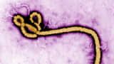 In this handout from the Center for Disease Control, a colorized transmission electron micrograph (TEM) of a Ebola virus virion is seen.