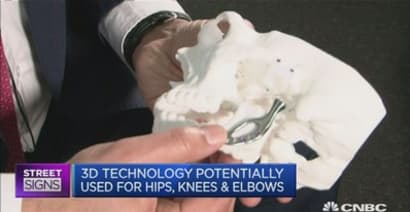 How 3D printing is changing the medical industry