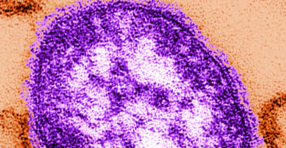 Nearly 250,000 U.S. kindergartners are vulnerable to measles, CDC says 