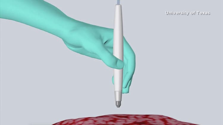 Scientists say they invented a cancer-detecting pen