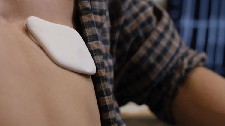Lief Therapeutics' new device helps you manage your stress