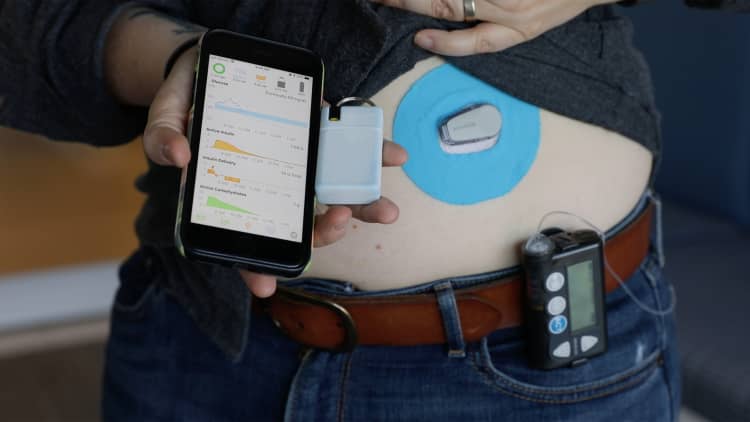 Insulin pumps are too slow to innovate — so diabetics are hacking them on their own