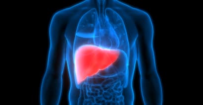 Healthy Returns: First NASH liver disease drug is here – and more are coming