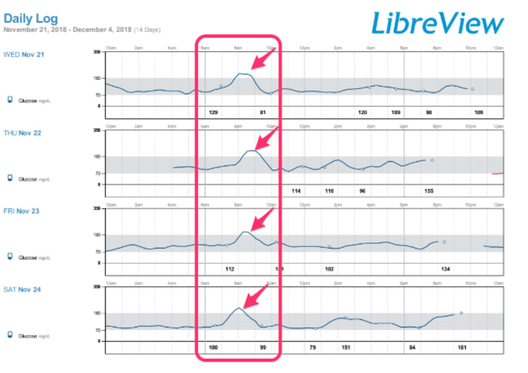Libreview data