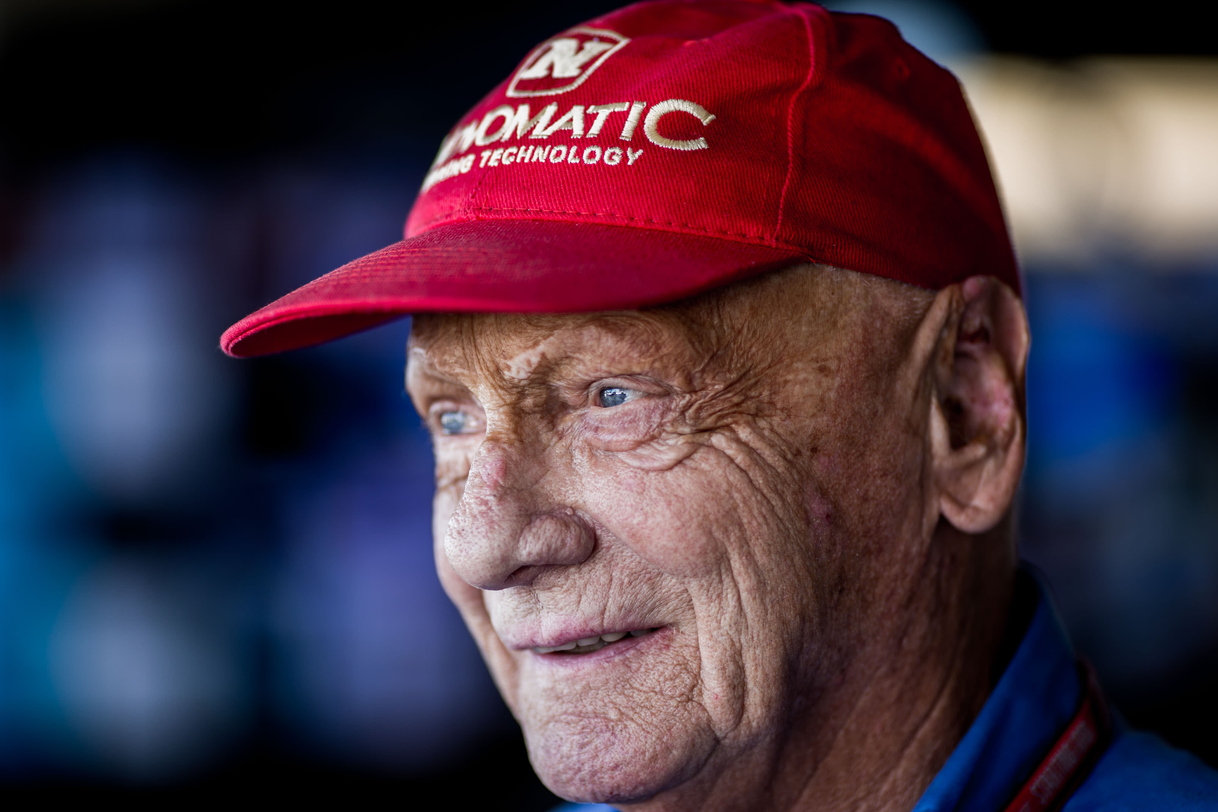 Niki Lauda Before And After