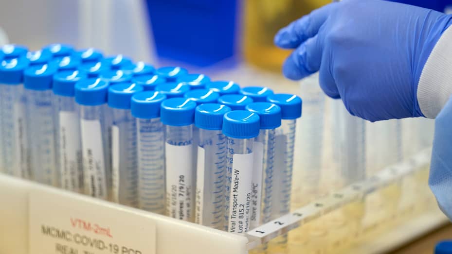 A lab at Methodist Dallas Medical Center prepares viral transport media for samples before collecting samples for coronavirus disease (COVID-19) in Dallas, Texas, U.S. June 24, 2020.