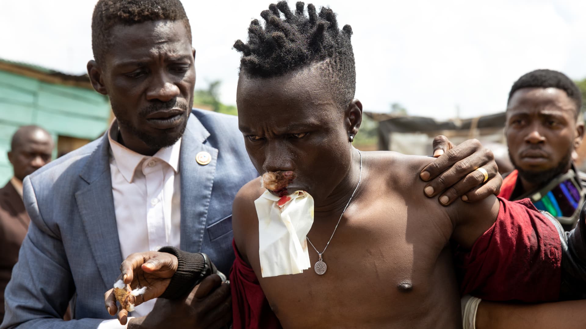 Bobi Wine takes an injured supporter into a medical center on December 01, 2020 in Jinja, Uganda.