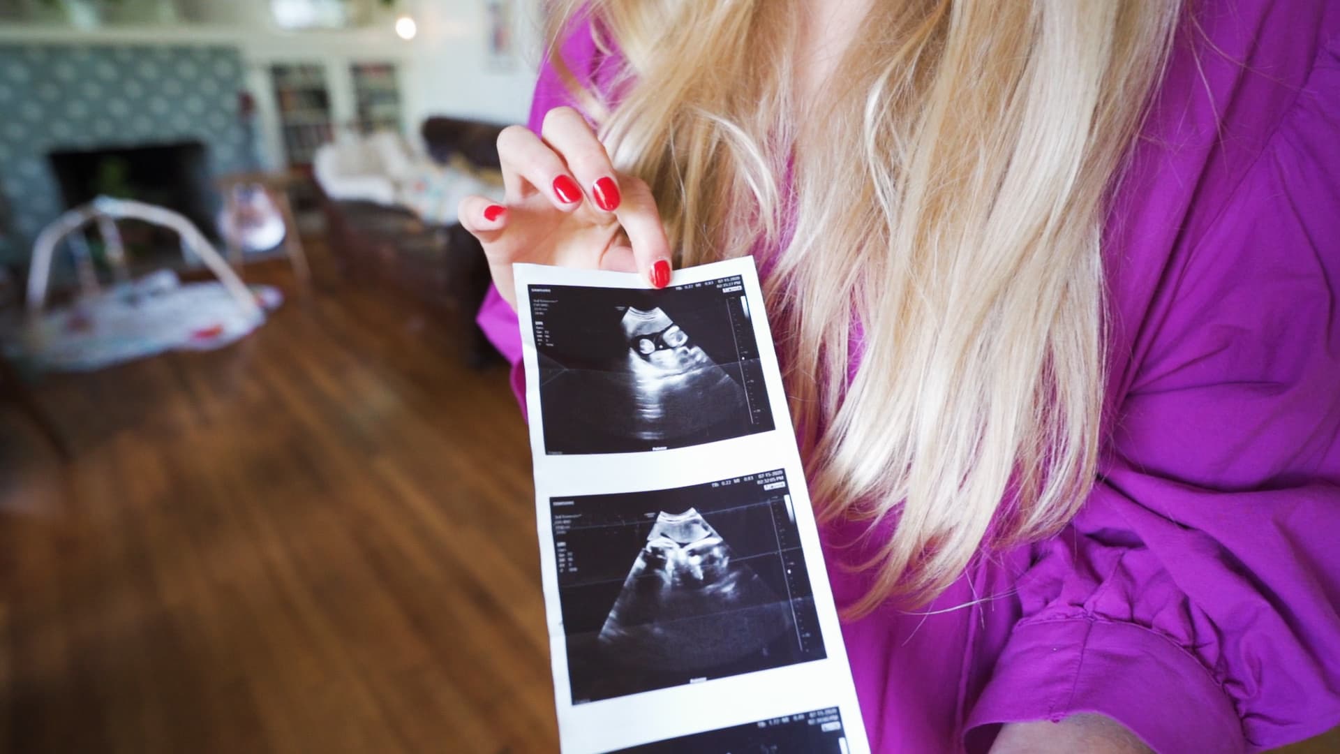 Kayla Picciuto Elia shares an ultrasound photo of the couple's son.