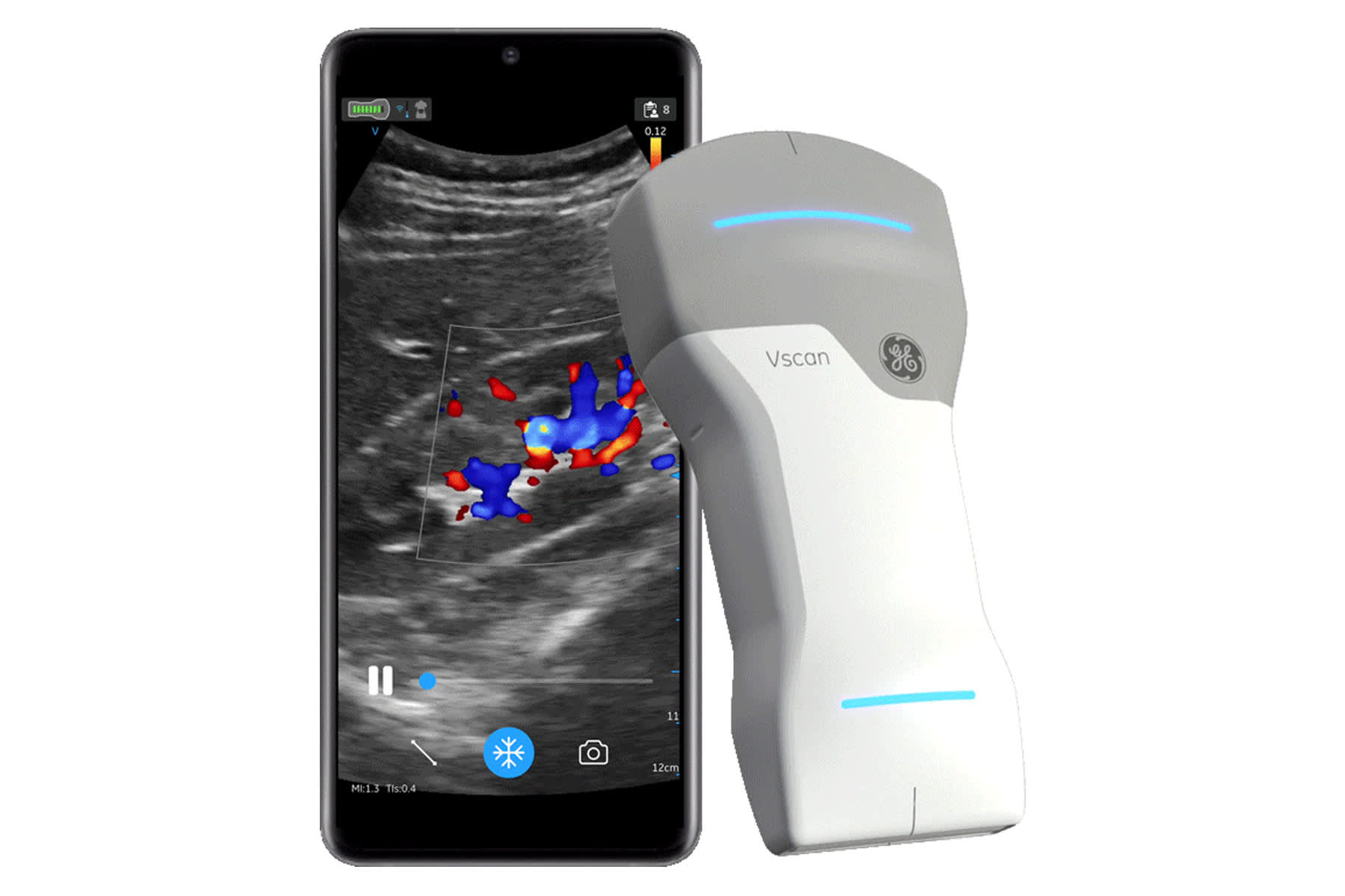 GE Healthcare Launches New Wireless Portable Ultrasound as CEO Takes Growing Market