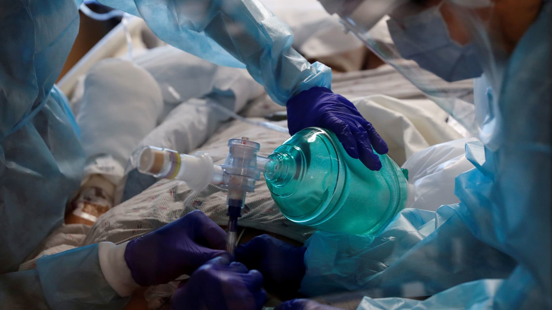 Critical care workers insert an endotracheal tube into a coronavirus disease (COVID-19) positive patient in the intensive care unit (ICU) at Sarasota Memorial Hospital in Sarasota, Florida, February 11, 2021.