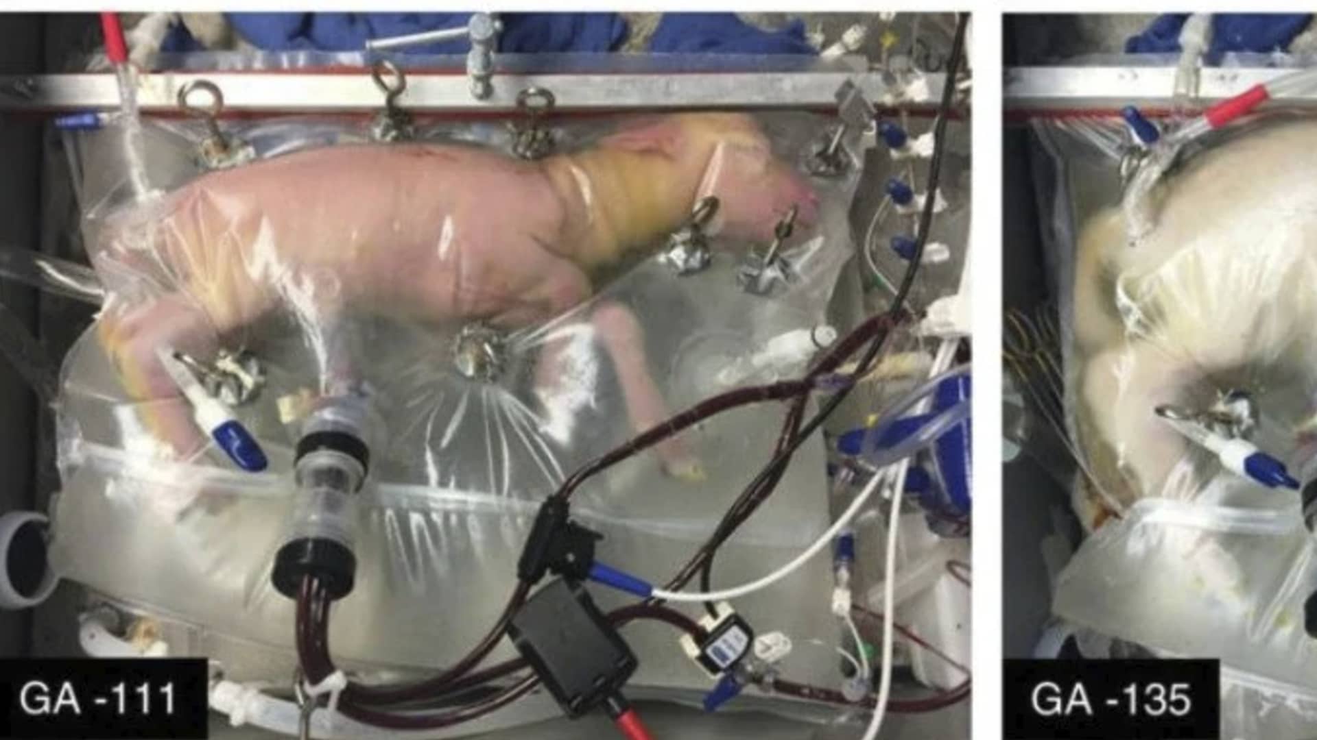 Researchers have successfully grown premature lambs in an artificial womb.