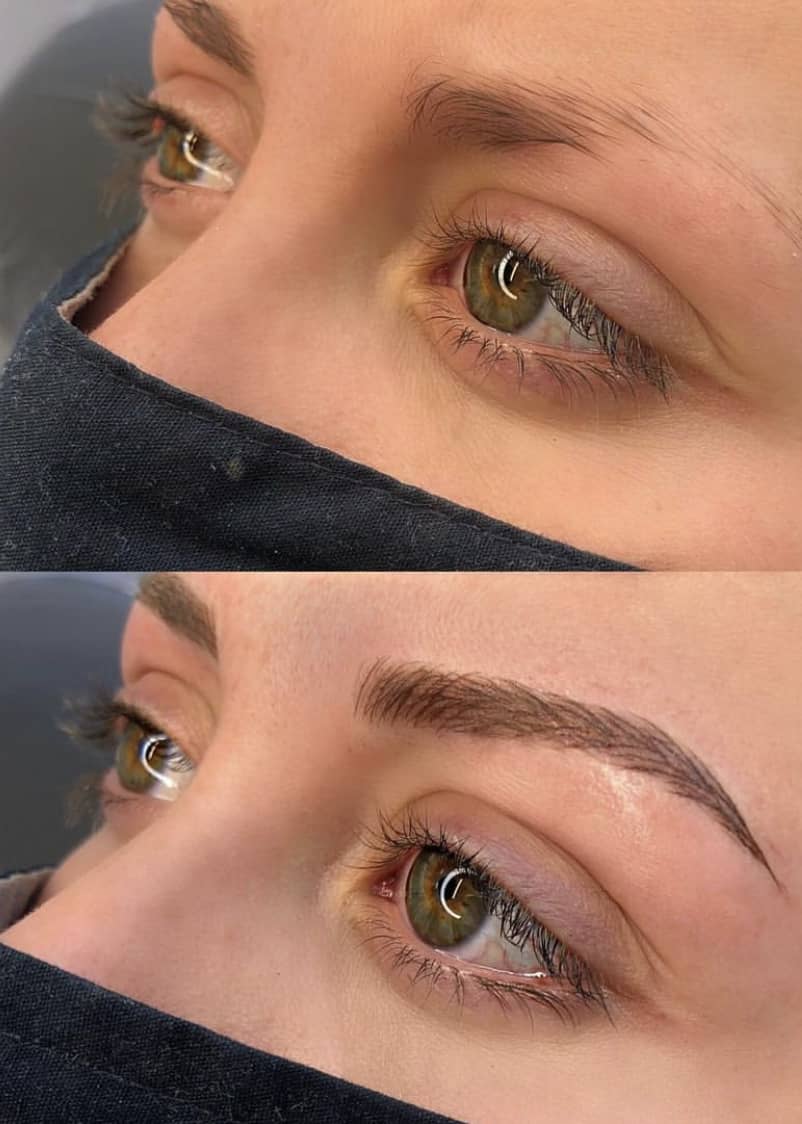 Microblading is a semi-permanent brow-enhancement procedure where small strokes — in the shape of individual hairs — are tattooed in the eyebrow areas.