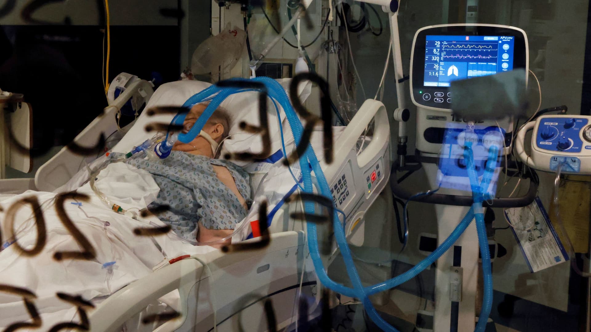 A coronavirus disease (COVID-19) patient lies intubated in their isolation room on the Intensive Care Unit (ICU) at Western Reserve Hospital in Cuyahoga Falls, Ohio, U.S., January 4, 2022.