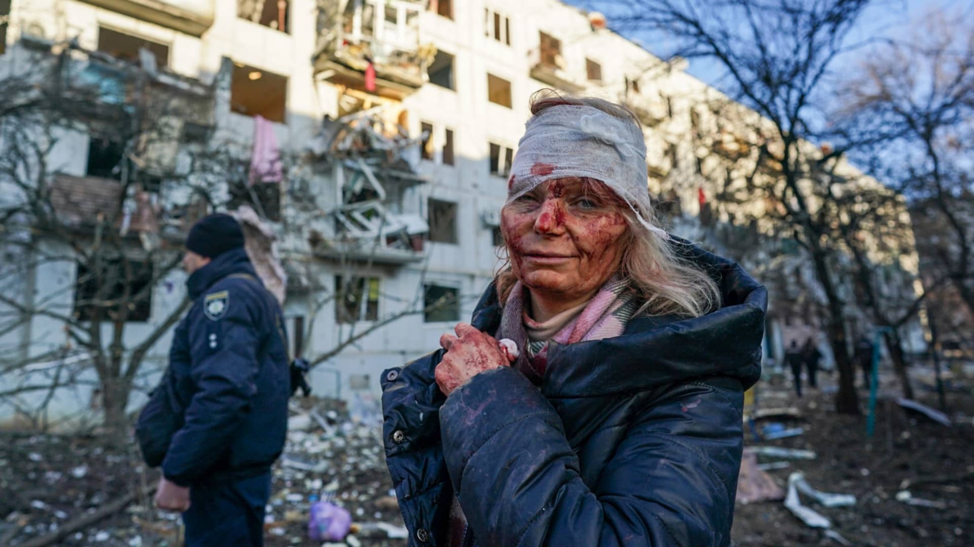 A wounded woman is seen after an airstrike damaged an apartment complex in city of Chuhuiv, Kharkiv Oblast, Ukraine on February 24, 2022.