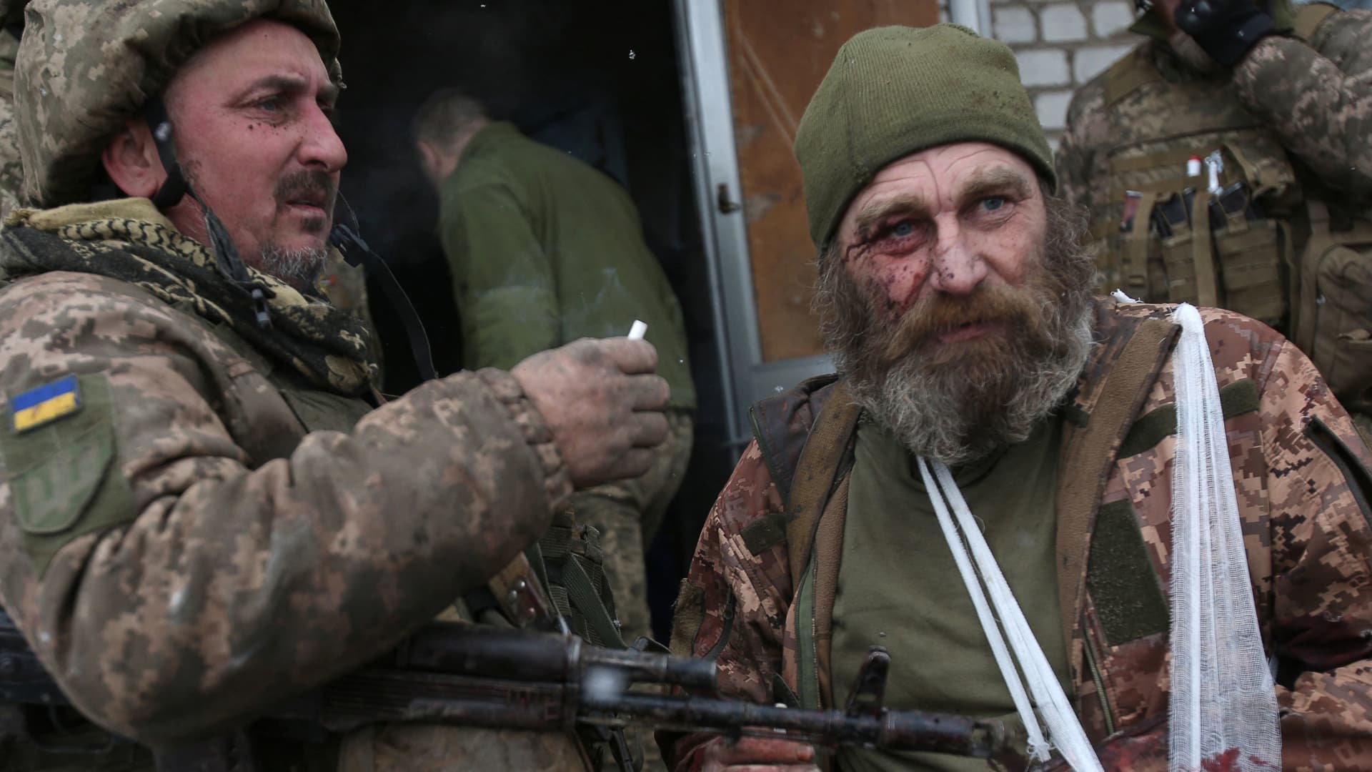 A wounded servicemen of Ukrainian Military Forces looks on after the battle with Russian troops and Russia-backed separatists in Lugansk region on March 8, 2022.
