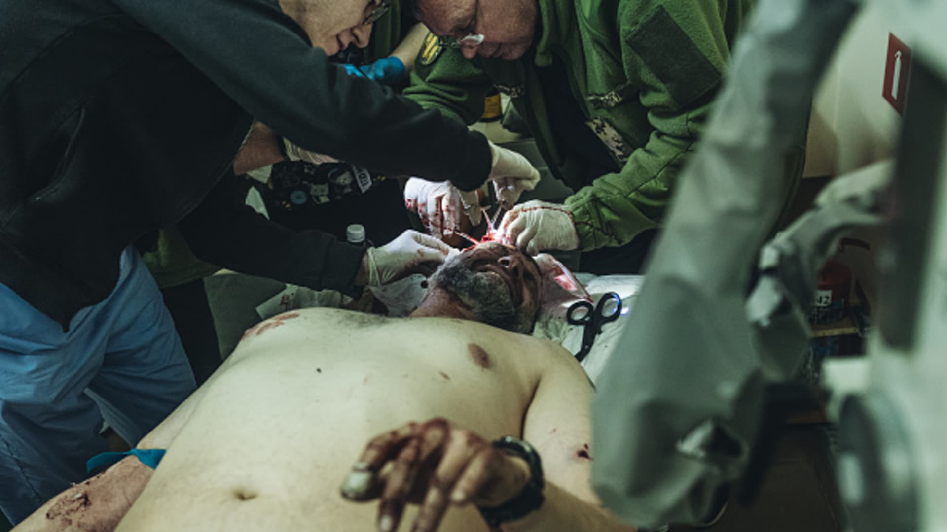 (EDITORS NOTE: Image depicts graphic content) A wounded Ukrainian soldier is being treated at the military hospital in Zaporizhzhya, Ukraine, 29 March 2022. 