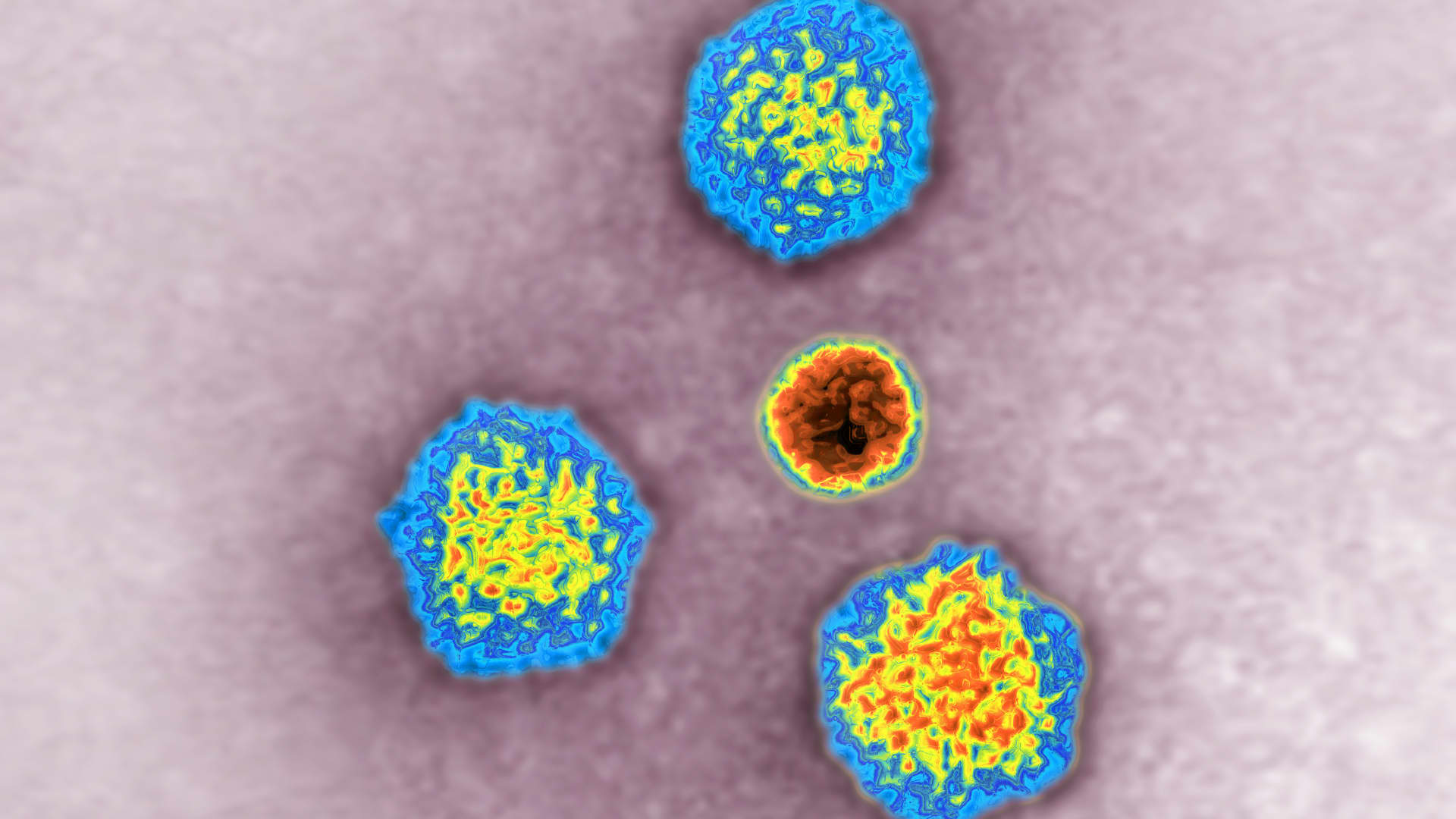 Hepatitis outbreak in kids may be linked to adenovirus, WHO says
