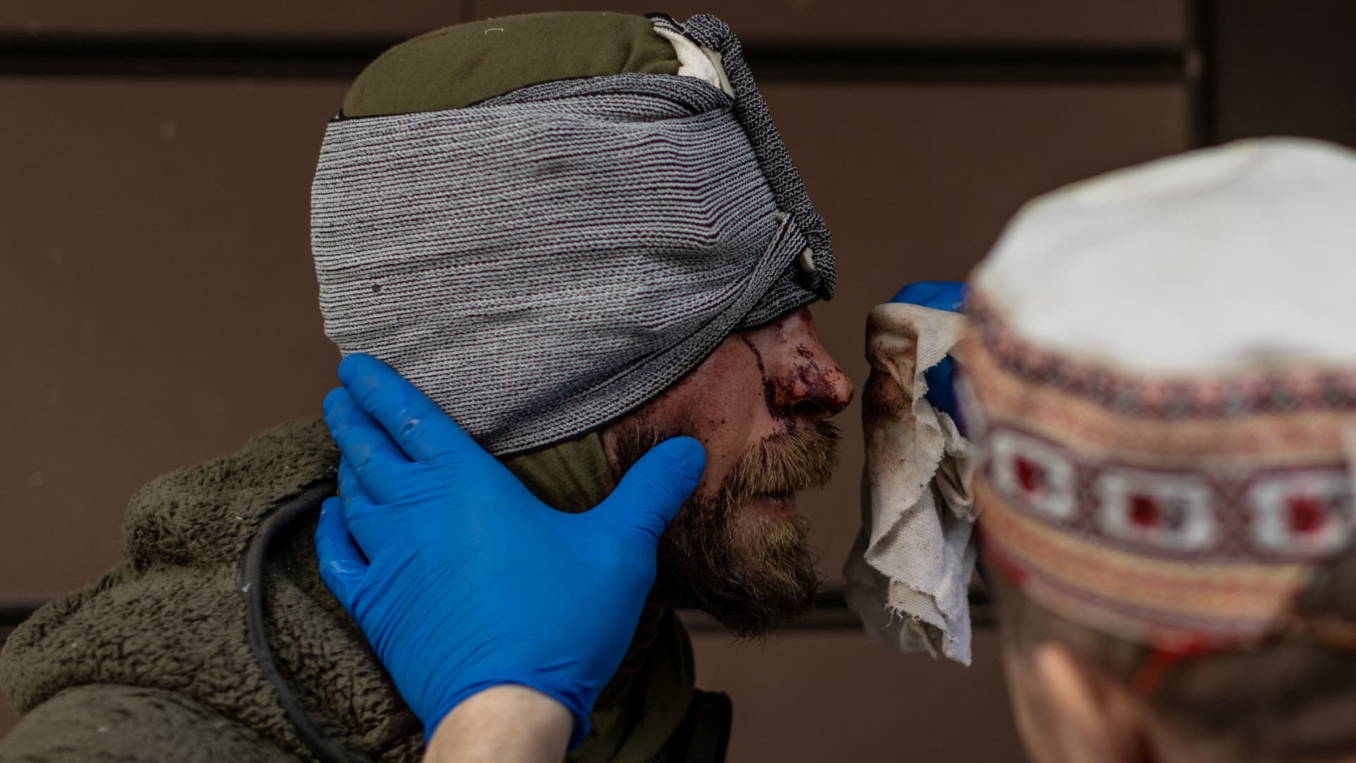 A nurse cleans blood from volunteer soldier Maksim, who was injured by shrapnel during combat in Popasna, amid Russia's invasion in Ukraine, outside the emergency room at a hospital in Bakhmut, Donetsk region, Ukraine, May 5, 2022. Maksim signed up to fight a week after the invasion started. 