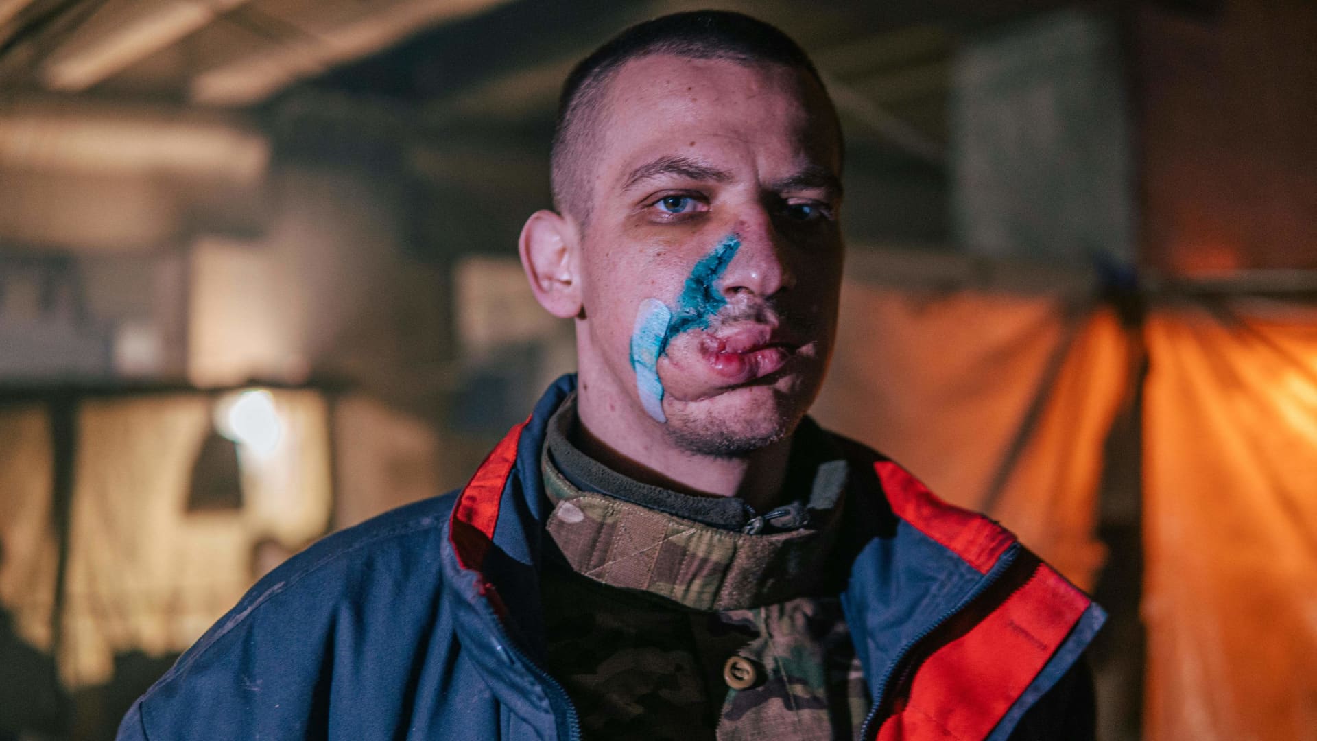 This photo released on May 10, 2022 by the Azov regiment shows an injured Ukrainian serviceman inside the Azovstal iron and steel works factory in eastern Mariupol, Ukraine, amid the Russian invasion.