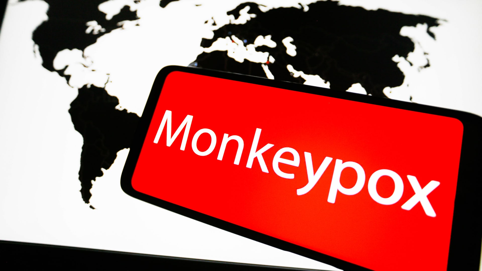 WHO declares spreading monkeypox outbreak a global health emergency
