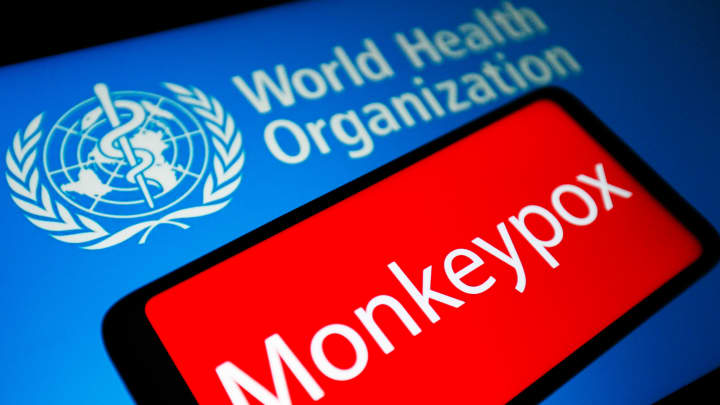 Although monkeypox can be transmitted sexually, it is not a sexually transmitted infection.
