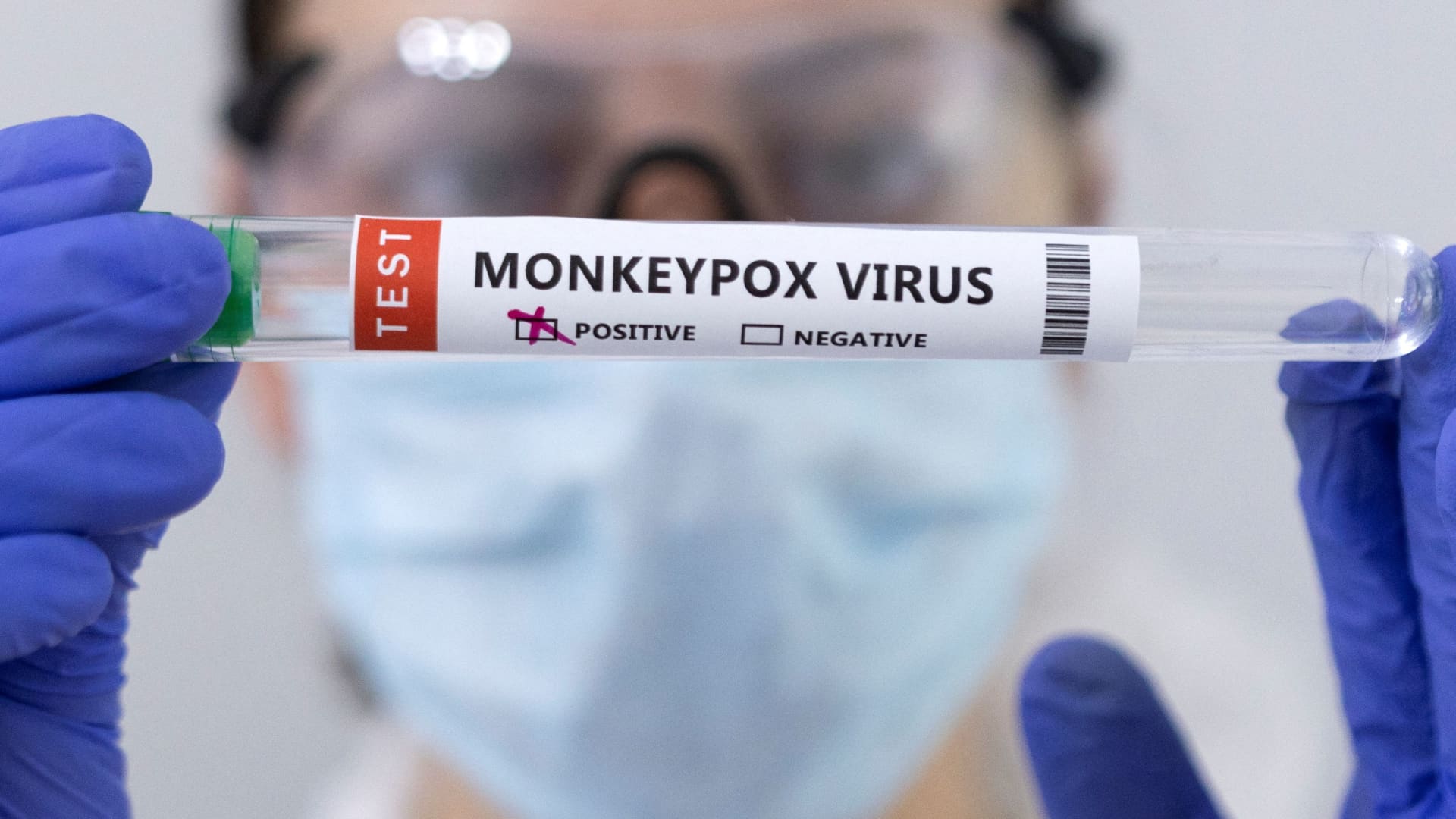 How to protect yourself against monkeypox and what to do if you catch it