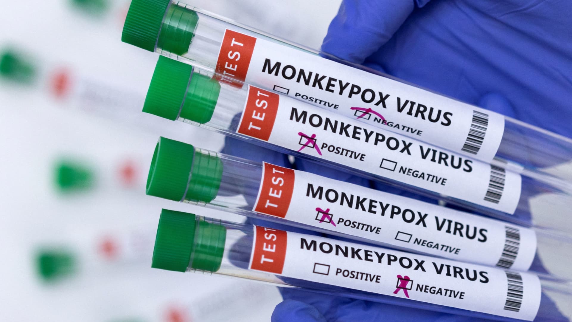 CDC raises monkeypox alert as global cases surpass 1000 – CNBC