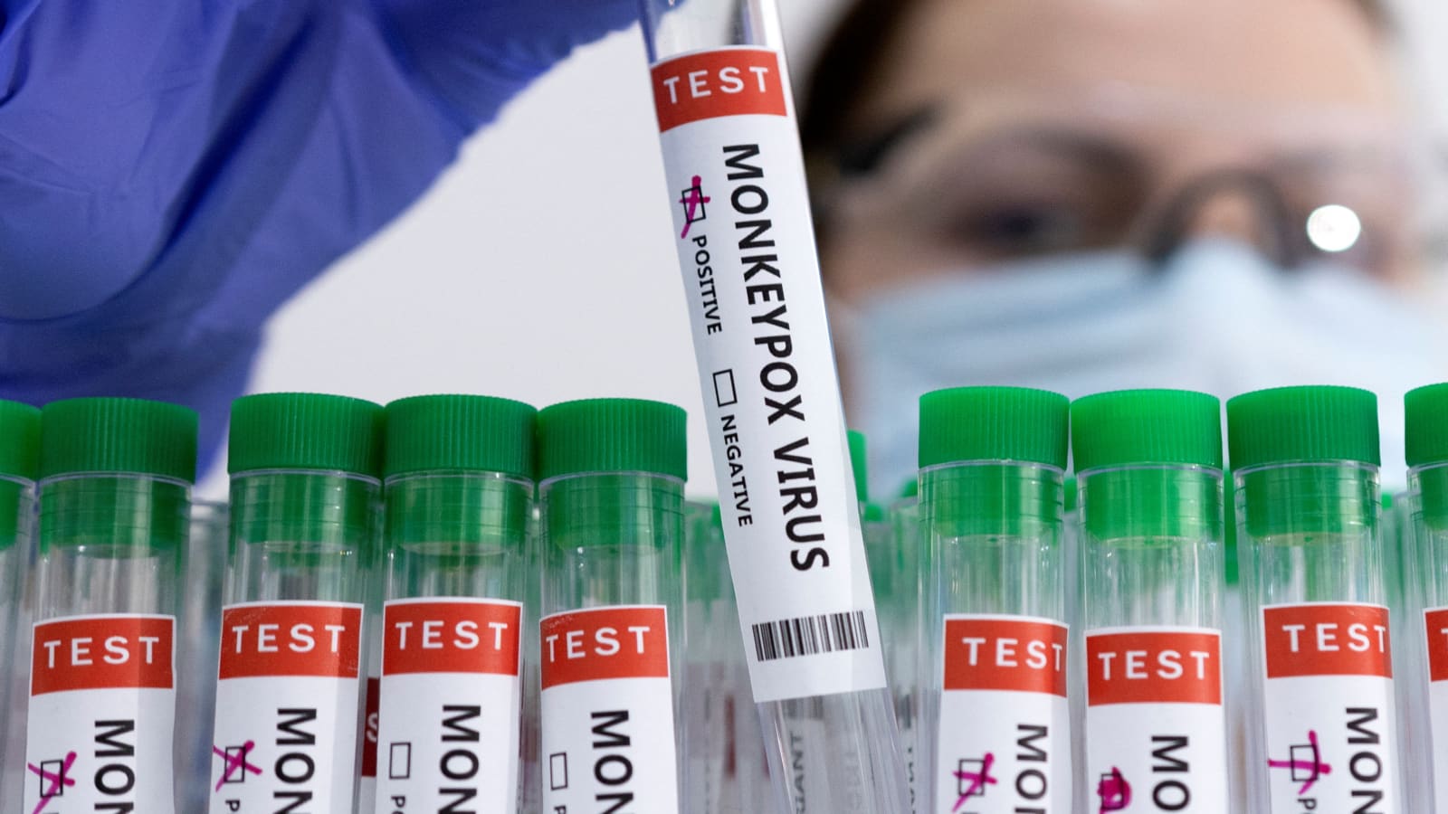 Roche develops test kits to detect monkeypox virus