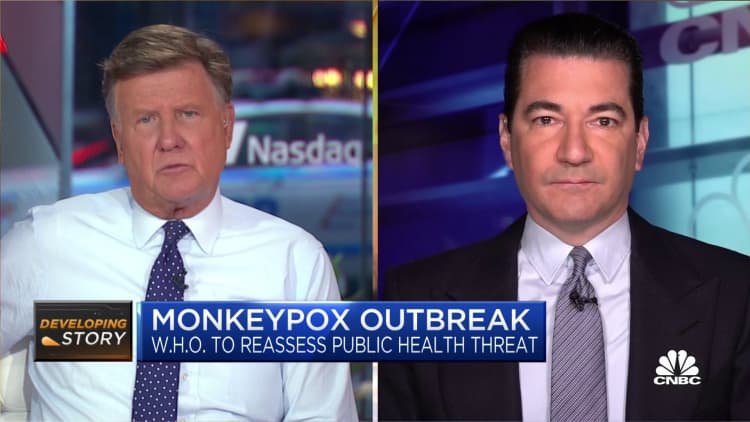 Monkeypox has likely broken out, will be hard to extinguish, says Dr. Scott Gottlieb