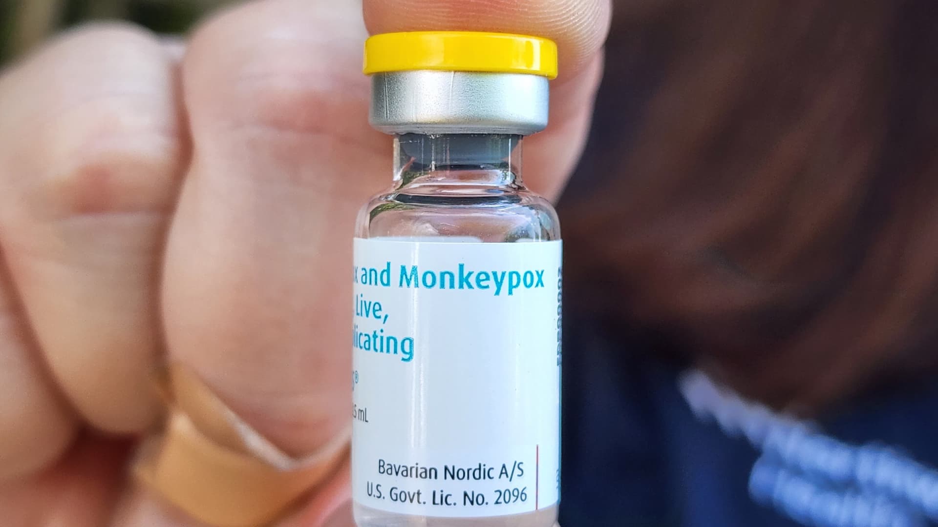 Ohio reports third U.S. death of person with monkeypox who had underlying health..