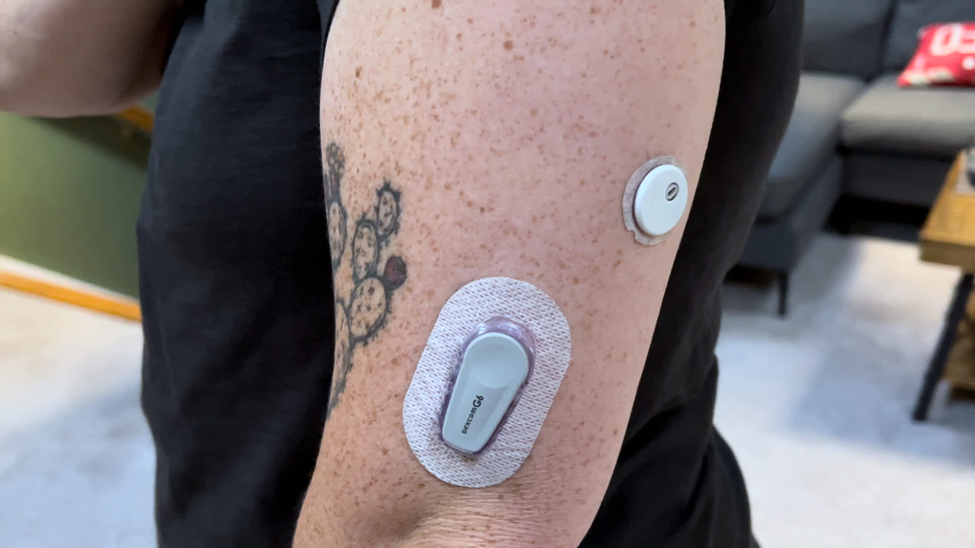 Dexcom announces its first-ever over-the-counter CGM Stelo has been cleared by the FDA 