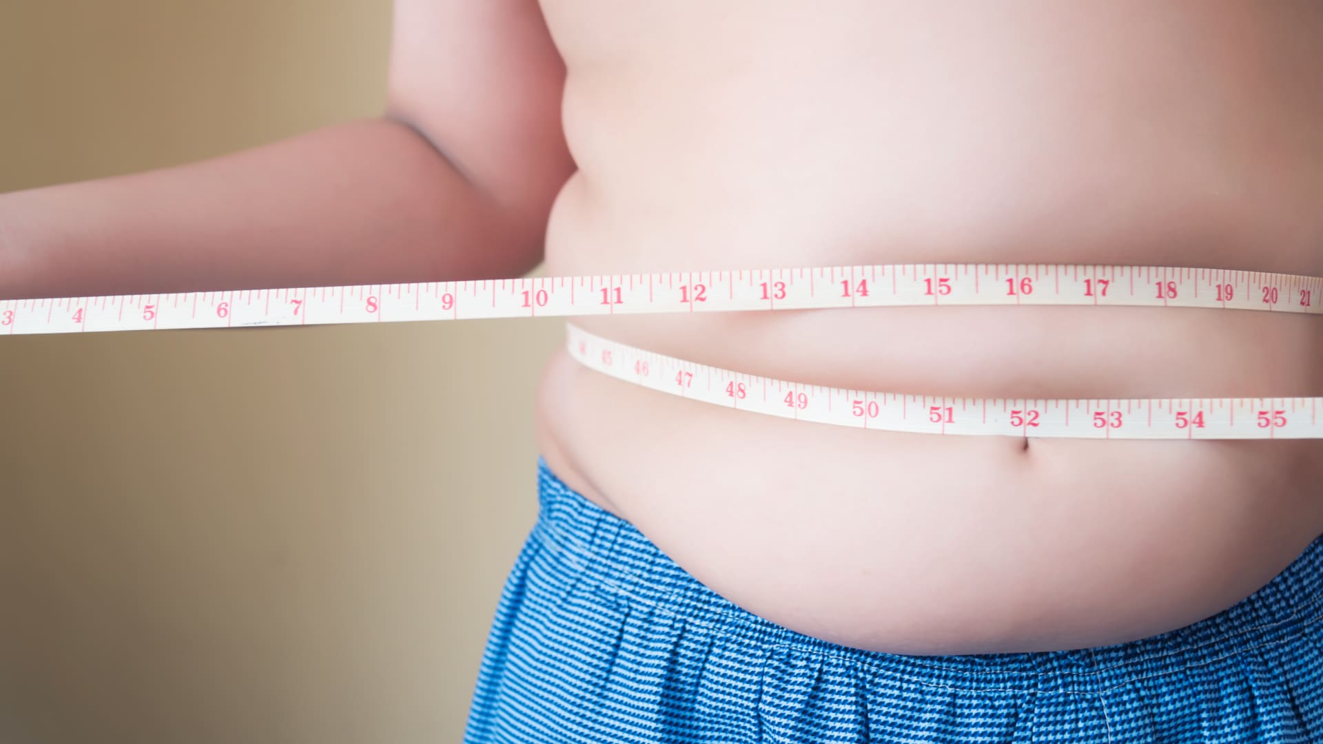 CDC expands BMI charts for severely overweight kids