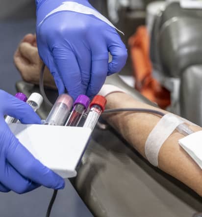FDA proposal would allow gay men in monogamous relationships to donate blood