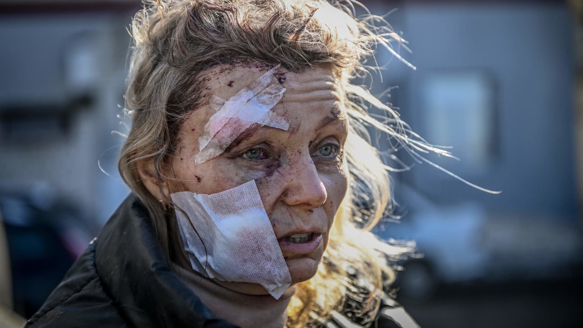 Olena Kurylo, a 52-year-old teacher, stands outside a hospital after the bombing of the eastern Ukraine town of Chuguiv on Feb. 24, 2022. Russian armed forces attempted to invade Ukraine from several directions, using rocket systems and helicopters to attack Ukrainian position in the south, the border guard service said.