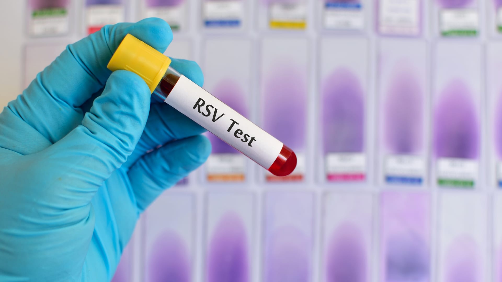 FDA advisors recommend first-ever RSV vaccine from Pfizer, despite possible Guillain-Barre risks