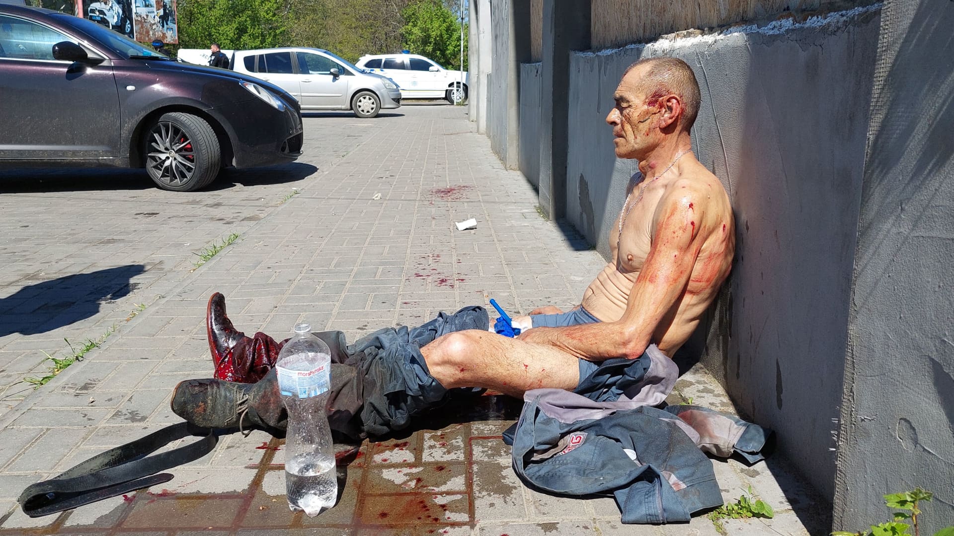 EDITORS NOTE: Graphic content: A wounded man sits outside of a local supermarket following Russian strikes in the southern Ukrainian town of Kherson on May 3, 2023, amid the Russian invasion of Ukraine.