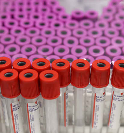 More gay and bisexual men can donate blood under new FDA rules