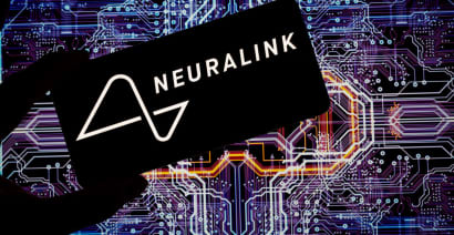 Neuralink says its in-human brain implant has encountered a problem 
