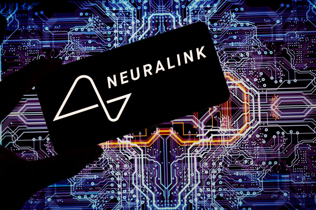 Neuralink dice que su primer implante de cerebro humano encuentra problemas