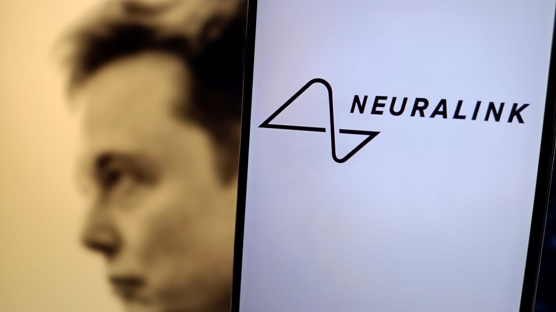 Elon Musks Neuralink rekrutiert Patienten für seine erste Studie am Menschen