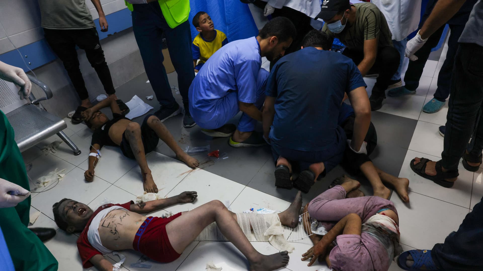 Medics attend to children, wounded by Israeli airstrikes, at Al-Shifa hospital in Gaza City on October 11, 2023.