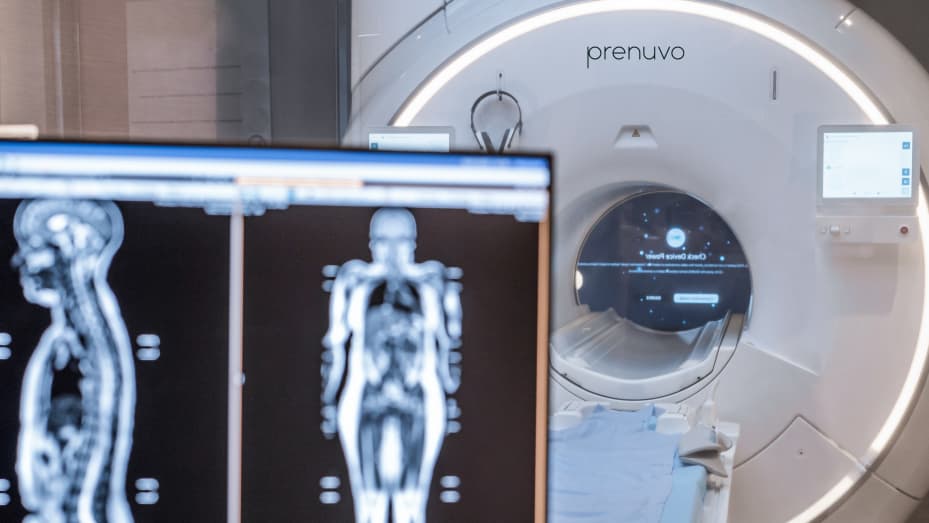Prenuvo offers $2,500 full-body MRI scans that can detect cancer early