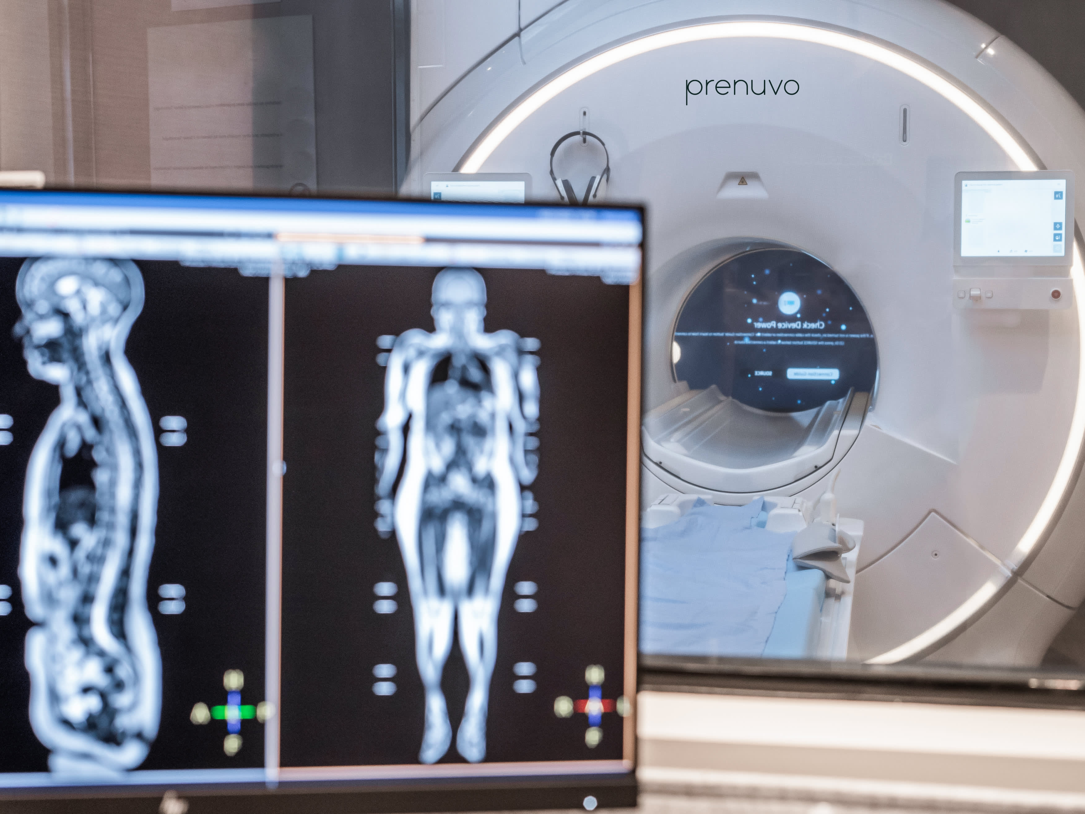 Prenuvo offers $2,500 full-body MRI scans that can detect cancer early