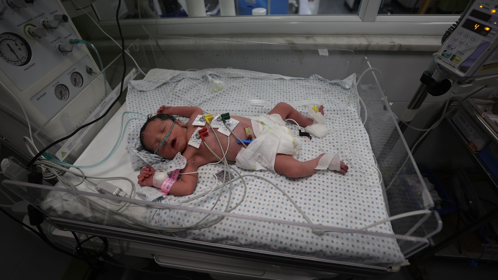 A newborn is seen at Nasser Hospital, born after his mother was killed in an Israeli airstrike in Khan Yunis, Gaza on October 24, 2023. The Palestinian doctor said the baby is now in a stable condition. (Photo by Mustafa Hassona/Anadolu via Getty Images)