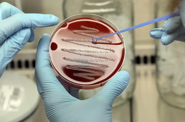 A hotter world makes it harder to stop the spread of superbugs