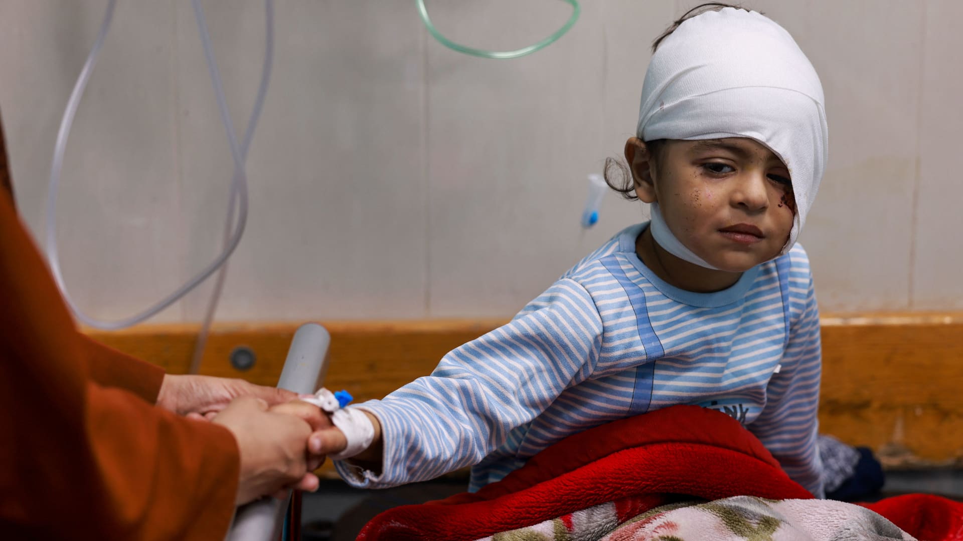 A wounded Palestinian child from the Jabalia refugee camp sits on a bed after being transferred from the Indonesian Hospital in the north to the Naser Hospital in Khan Yunis, on November 21, 2023, amid the ongoing battles between Israel and the Palestinian militant group Hamas.