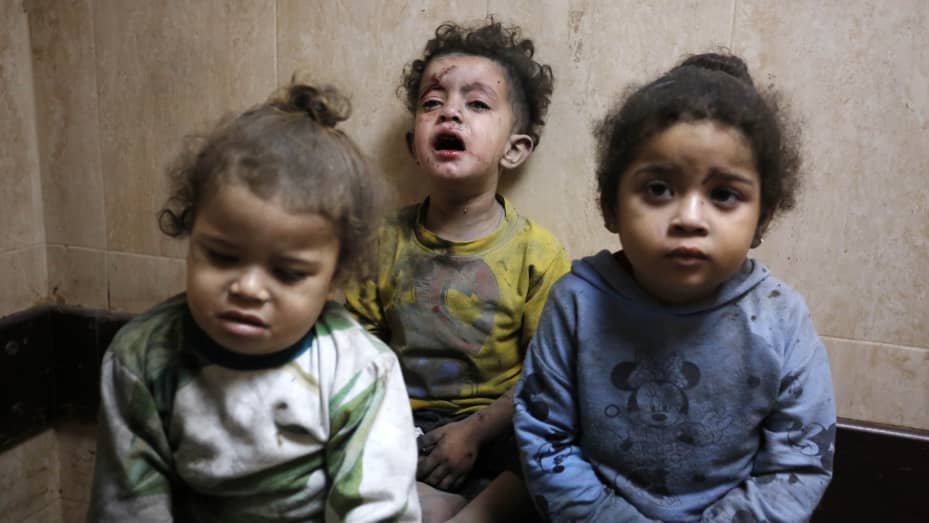 (NOTA DEL EDITOR: La imagen muestra contenido gráfico) Se ve a niños heridos como resultado de los ataques del ejército israelí en el Hospital de los Mártires de Al-Aqsa, en Deir Al-Balah, Gaza, el 22 de noviembre de 2023 (Foto de Ashraf Amra/ Anadolu vía Getty Images)