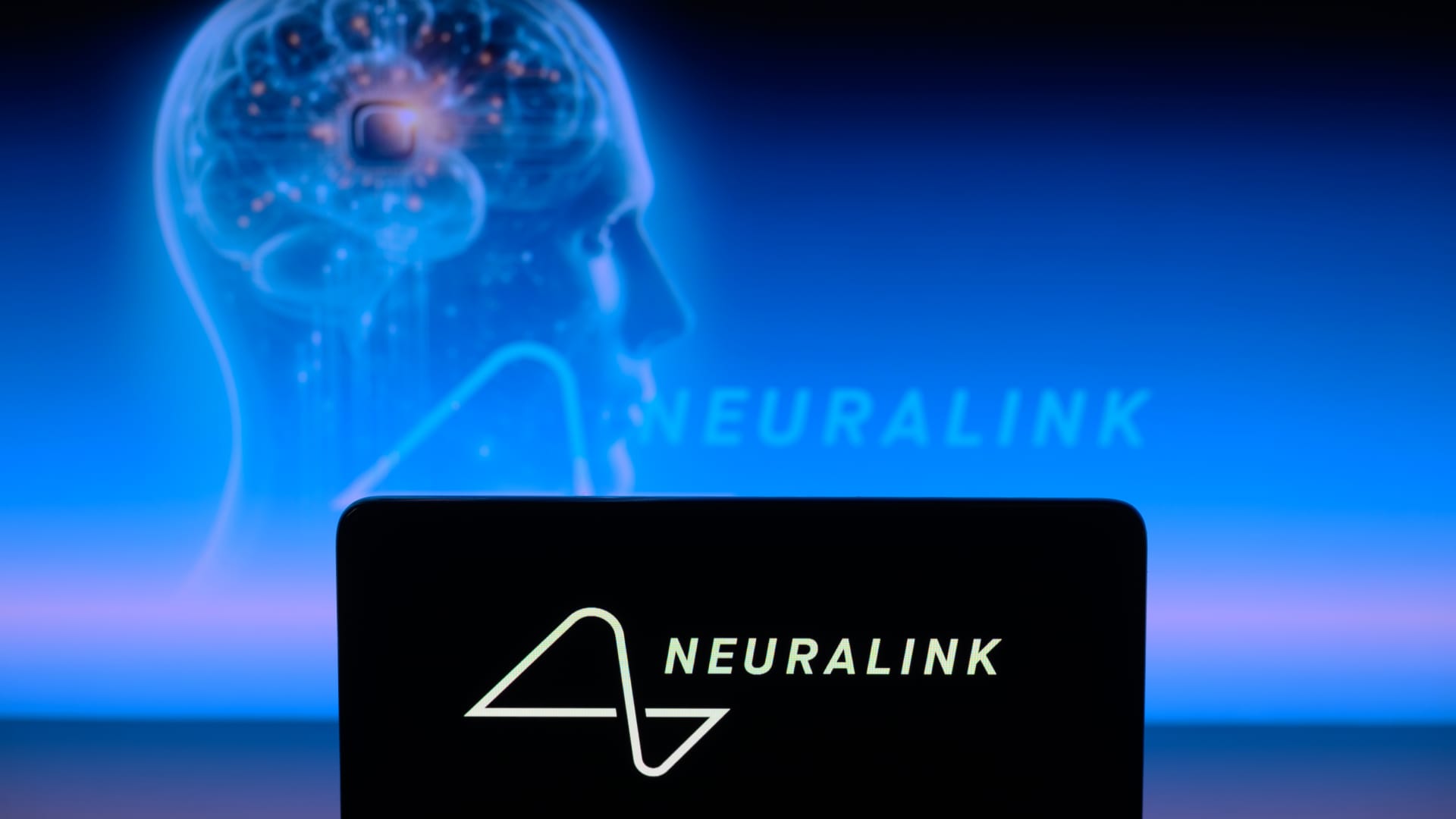 Neuralink shares video of patient playing chess using signals from brain implant 